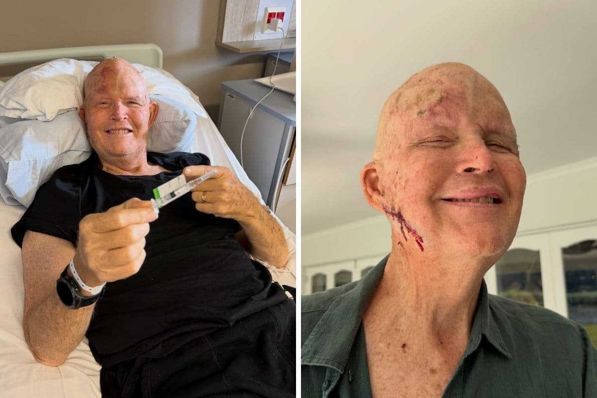 New hope: Oscar Chalupsky starts ‘life-saving’ treatment